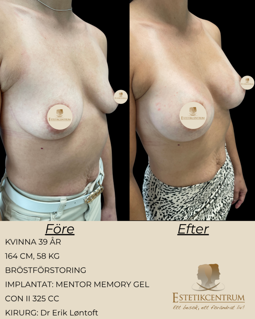 Estetikcentrum Operationer