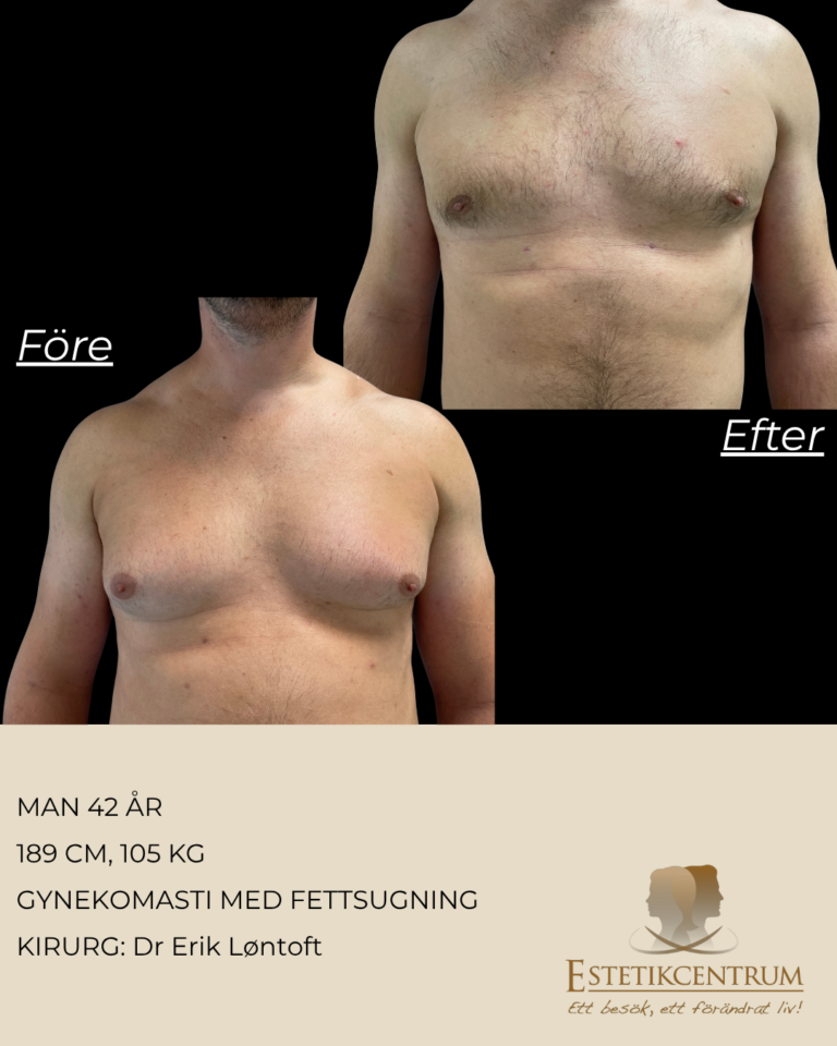Foreefter-2026-META-15.png