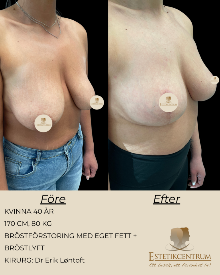 Foreefter-2026-META-8.png
