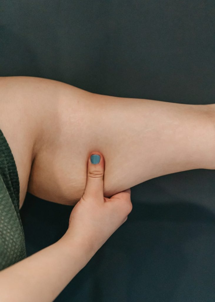 Kvinna trycker på hängande hud på överarmen