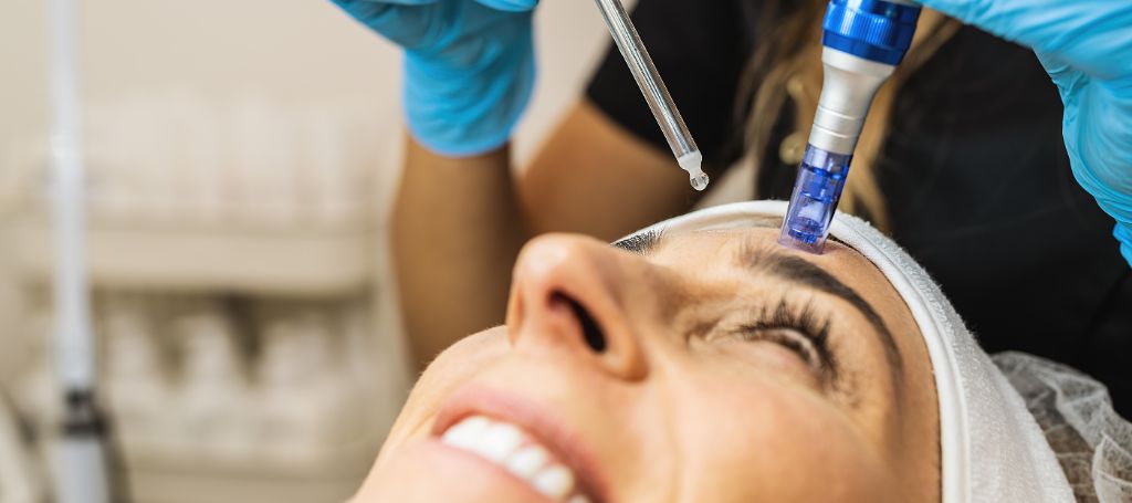 Microneedling Malmö: Varför denna behandling är så populär?